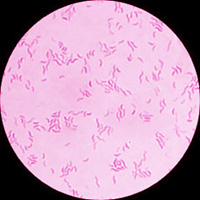 CAMPYLOBACTER