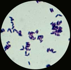 CORYNEBACTERIUM