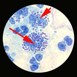 LE DIAGNOSTIC BACTERIOLOGIQUE D'UNE INFECTION BACTERIENNE I