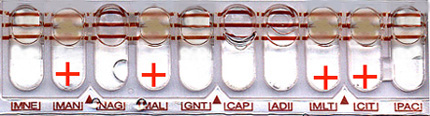 Auxanogramme Auxanogramme