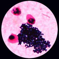 comment soigner staphylococcus epidermidis